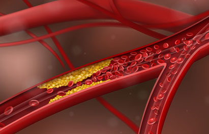 How Do You Increase Testosterone Naturally?